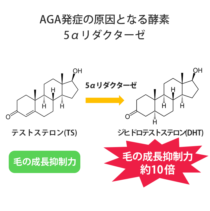 5aリダクターゼ